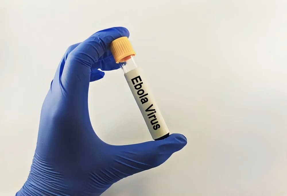 EMA I AMA Ubrzavaju Planiranje Kliničkih Ispitivanja Protiv Bundibugyo Ebole