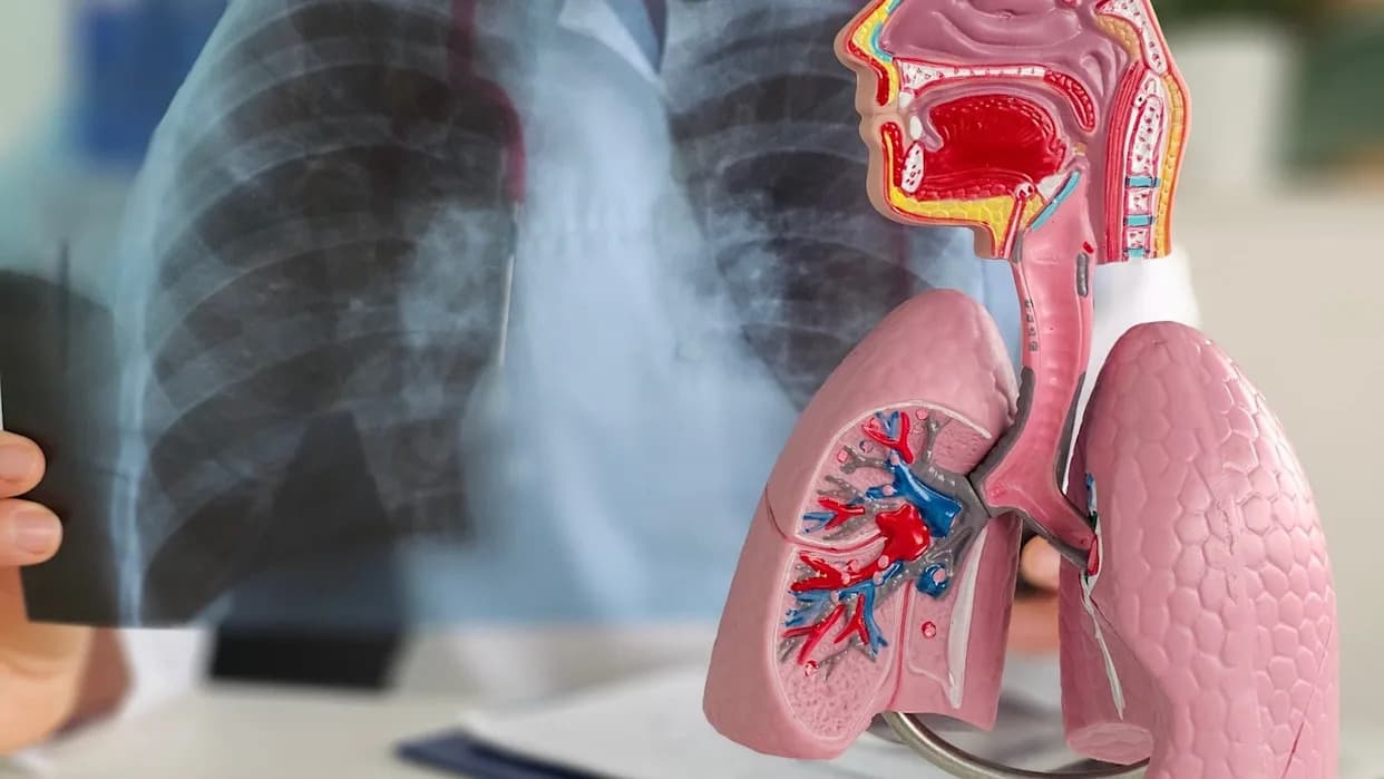 Massive Bio i Optellum Povezuju Rano Otkrivanje NSCLC Sa Direktnim Pristupom Kliničkim Ispitivanjima