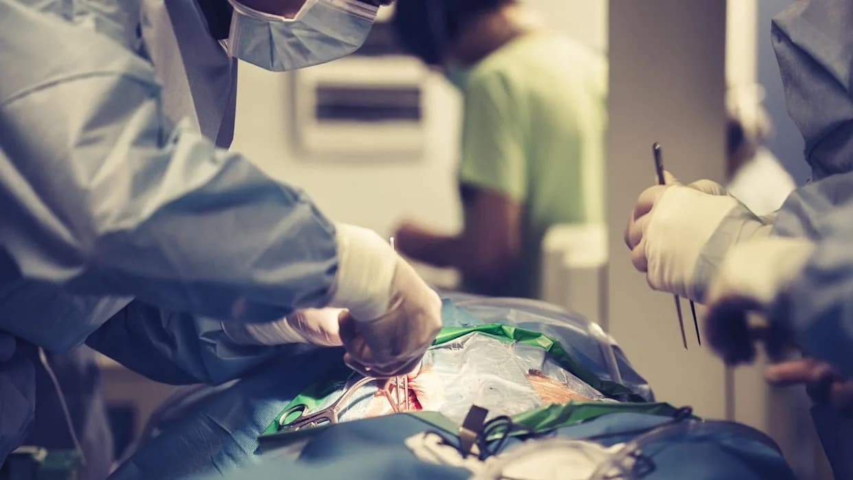 FDA Odobrila PMA Za Artivionov AMDS Hybrid Prosthesis — Važna Novost Za Tretman Akutnih DeBakey Tip I Disekcija