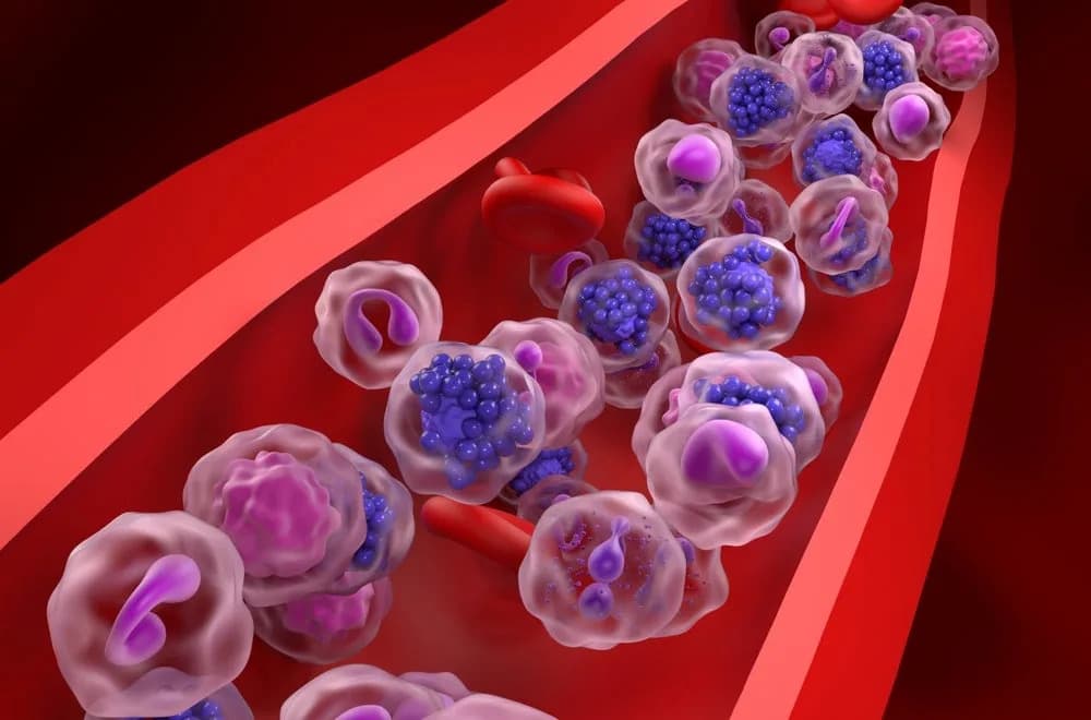 Epkinly + Revlimid Znatno Produžava PFS u Fazi III Ispitivanja Kod R/R DLBCL