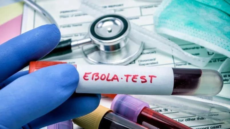 Pacijent Testiran Na Ebolu U Glazgovu — Rezultat Negativan, Rizik Za Javnost Nizak