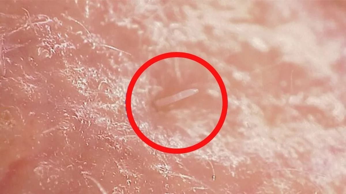 Grinje Na Licu Se 'Spajaju' S Nama — Genom Pokazuje Prelaz Ka Simbiozi