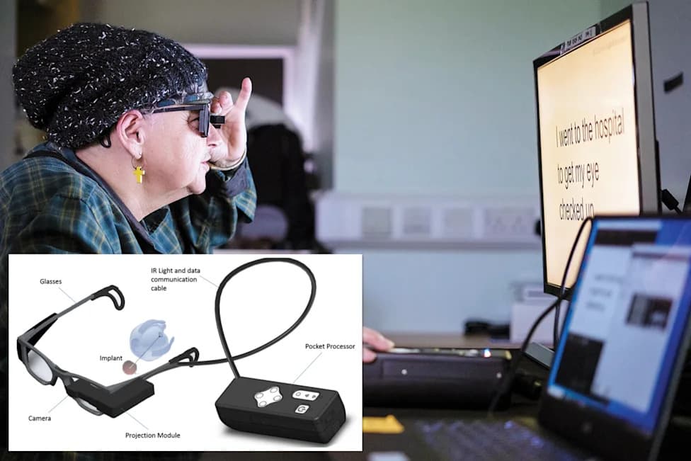 PRIMA: Mini-implant Sa Stanforda Vraća Vid Nekim Slepim Odraslim Osobama