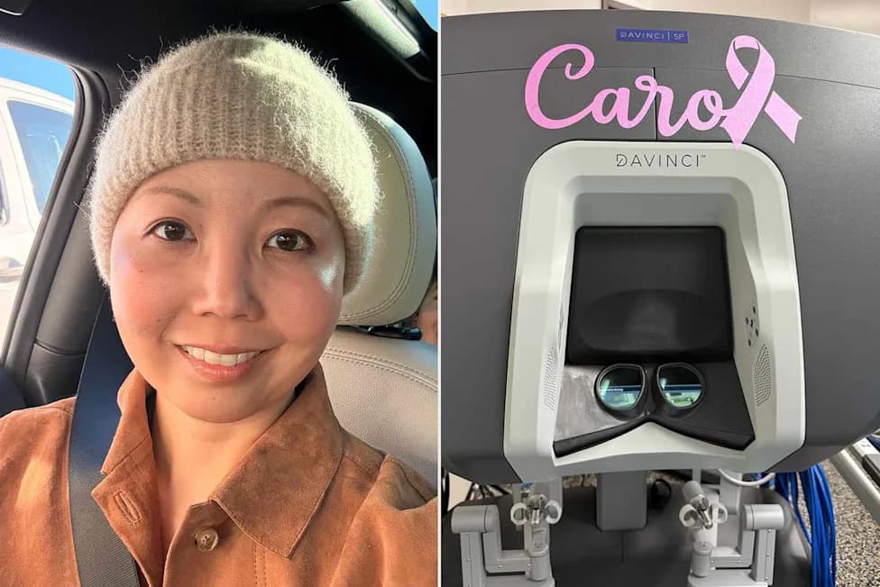 Medicinska istorija: Prva jednoprstavna robotizovana mastektomija sa očuvanjem bradavice u SAD‑u izvedena robotom „Carol”