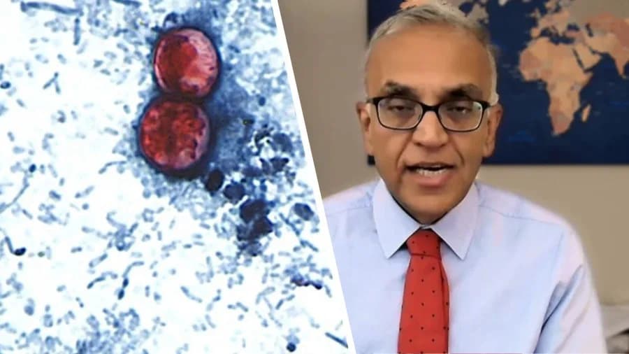 Izvor epidemije parazita možda nikad neće biti pronađen, upozorava stručnjak
