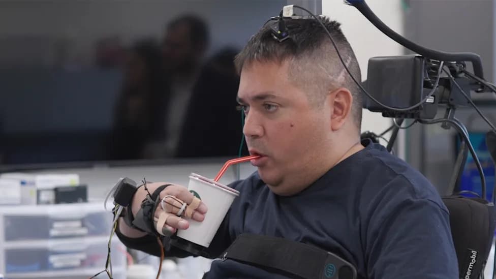 Revolucionarni 'double neural bypass': Pacijent sa kvadriplegijom ponovo može da se hrani i oseti dodir