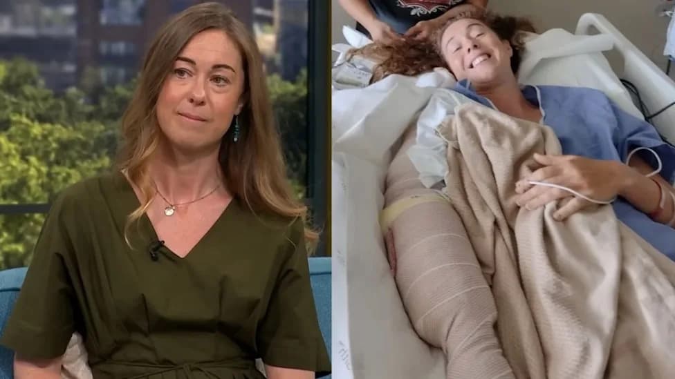 «Nedostaje Deo Ruke»: Naučnica Helen Fairlamb Pokazala Posledice Napada Ajkule na Havajima