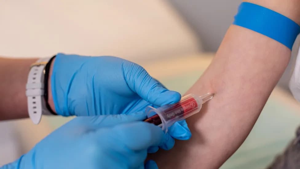 Nova studija iz Rima: Mikroplastika češće u krvi pacijenata sa infarktom — šta to znači za zdravlje srca?
