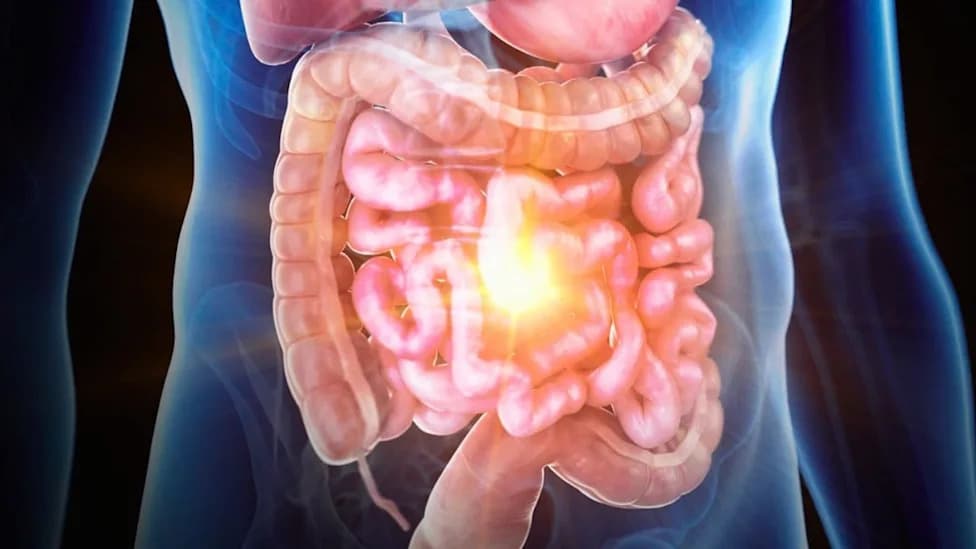 Inflamatorna bolest creva reproducirana na čipu: Colon Chip otkriva ključnu ulogu fibroblasta