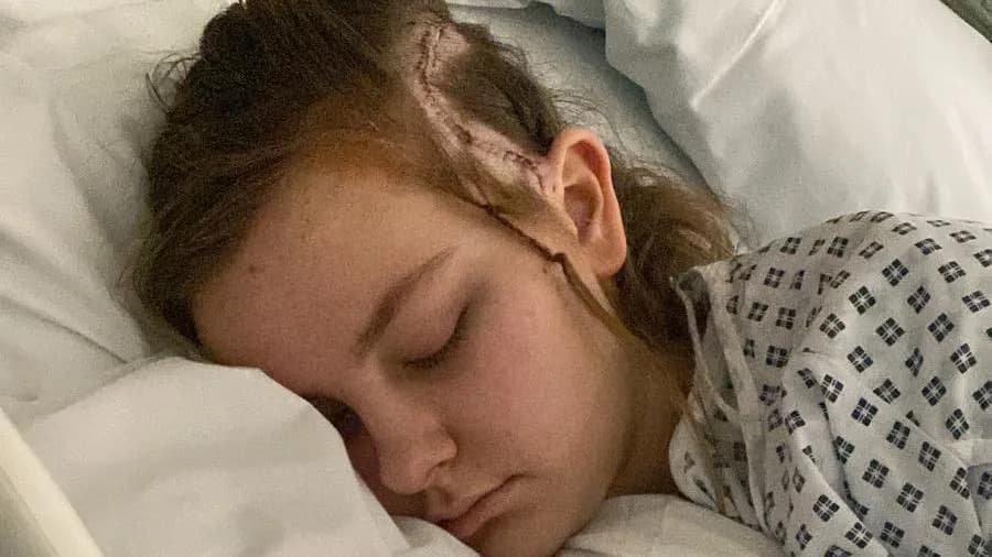 15-godišnja Tilly Najmlađa Poznata Pacijentkinja Pod Budnom Operacijom Mozga