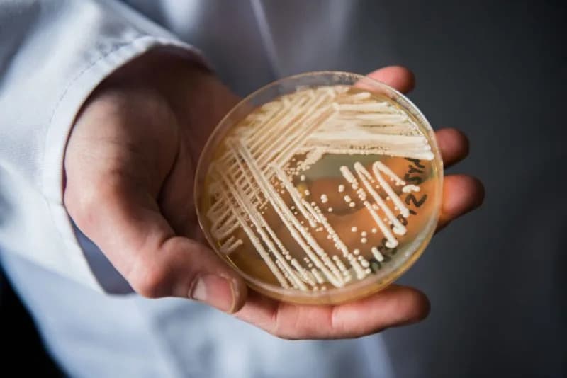Superbug Potvrđen U 23 Države: Gde Se Širi Smrtonosna Gljivica Candida auris U 2026.?