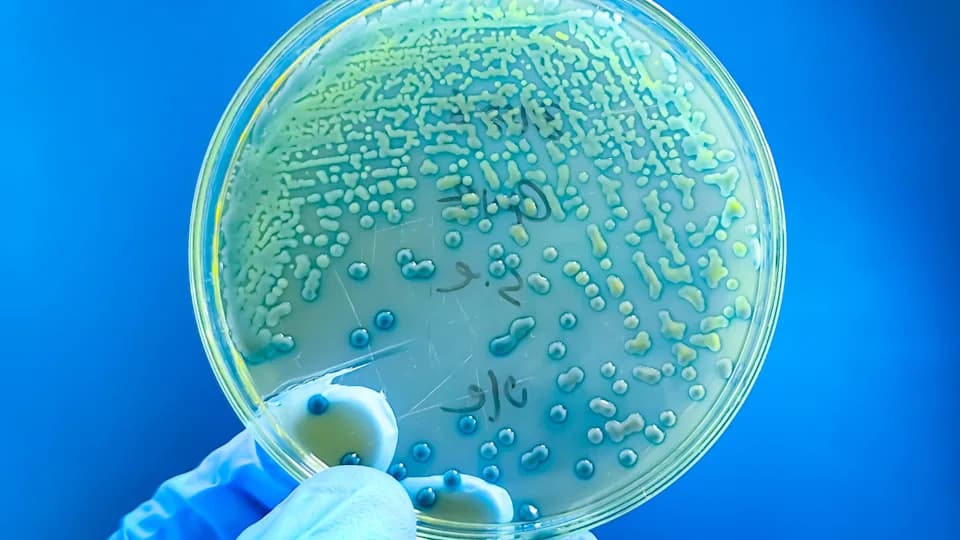 Alarmantno: Otpornost Bakterija Na Antibiotike Kod Dece Raste — Studija Upozorava Na Pogoršanje Do 2035.