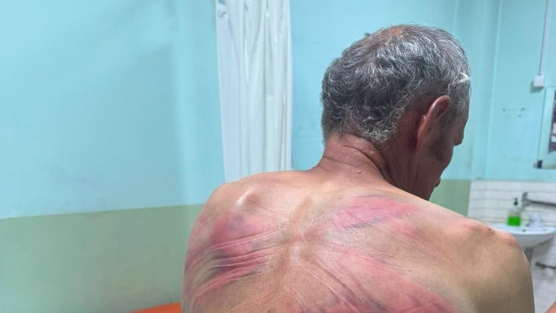 Nasilje u Drenu kod Zubinog Potoka: Nenad Rašković Navodno Pretučen i Vezan Za Drvo, Poziv Na Nezavisnu Istragu