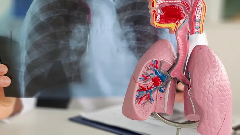 FDA dodelila "Breakthrough" status Freenomeovom SimpleScreen Lung testu — neinvazivni krvni skrining za rak pluća