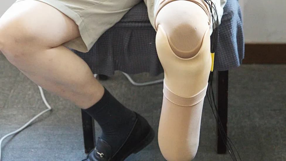 Veštačka "Koža" Za Proteze Koja Upozorava Na Opasan Pritisak Pre Povrede