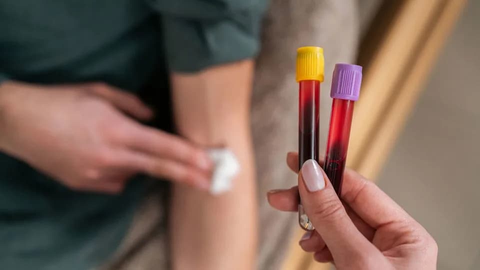 Rutinski krvni testovi mogu otkriti skriveni trag za rani kolorektalni karcinom: šta znači niži AST i ALT?